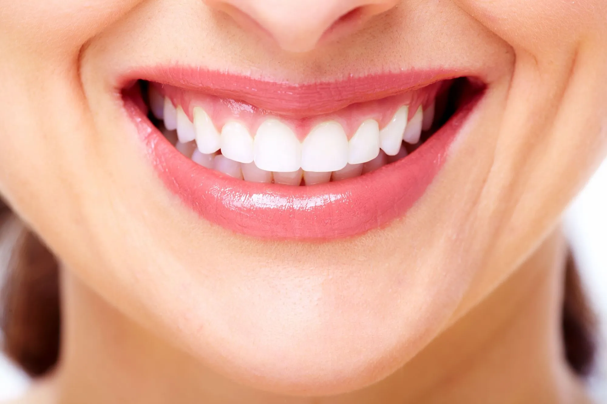 Non-Surgical Gum Treatment in Prairieville